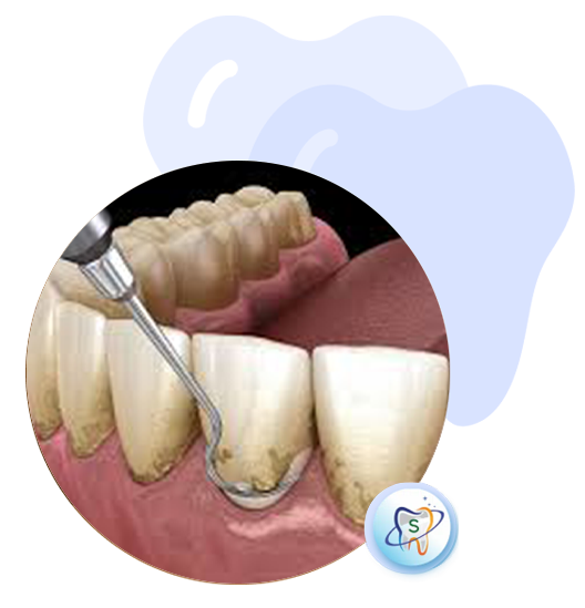 Dental Braces